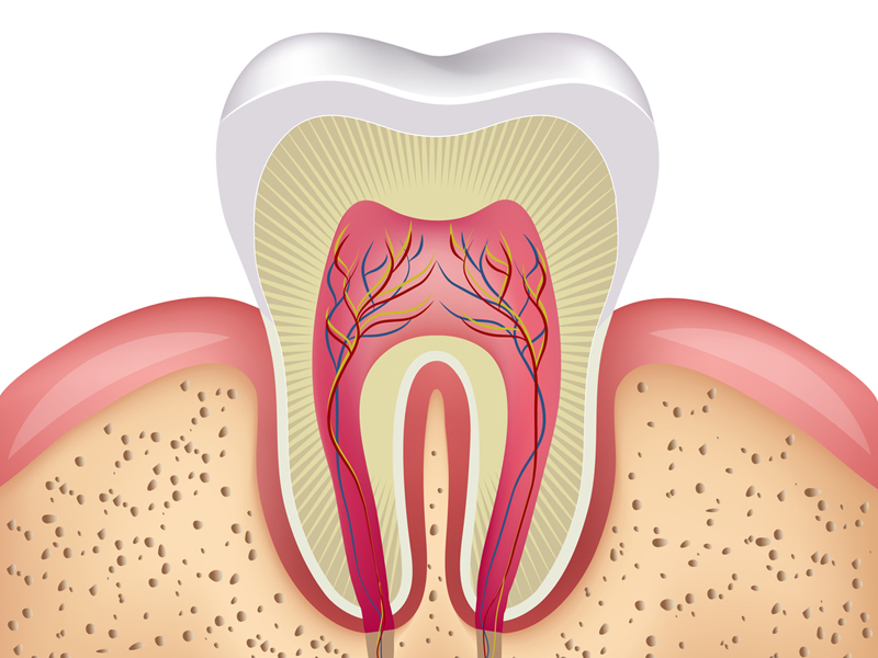 root-canal-image